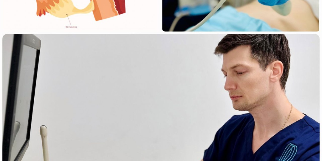 ГИНЕКОЛОГИЯ: ПРОБЛЕМЫ С ЗАЧАТИЕМ