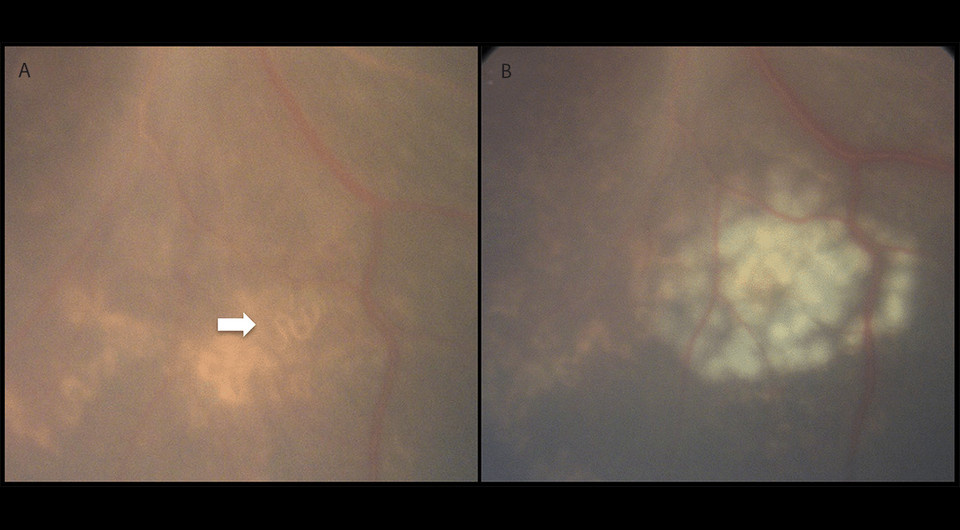   Aisling M. Vaughan et al. / MMWR, 2025