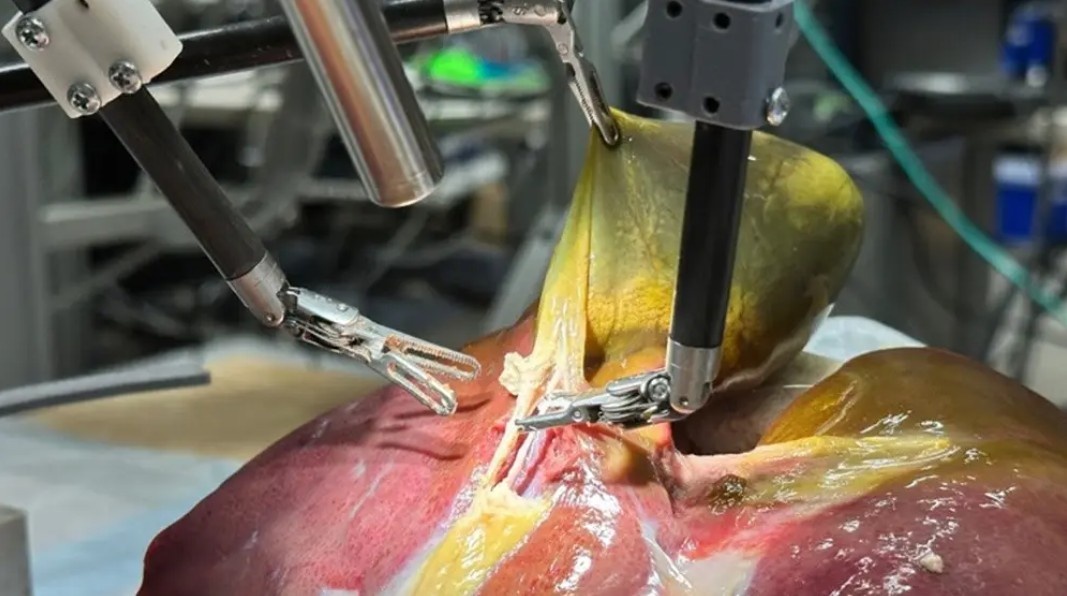 Фото: Juo-Tung Chen, Johns Hopkins University