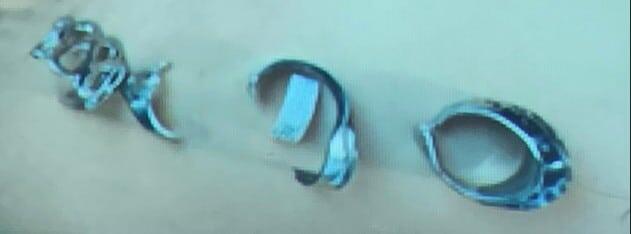    Срезанные с пениса металлические кольца / © Gonzalez-Carranza H. R., Cureus (2025)