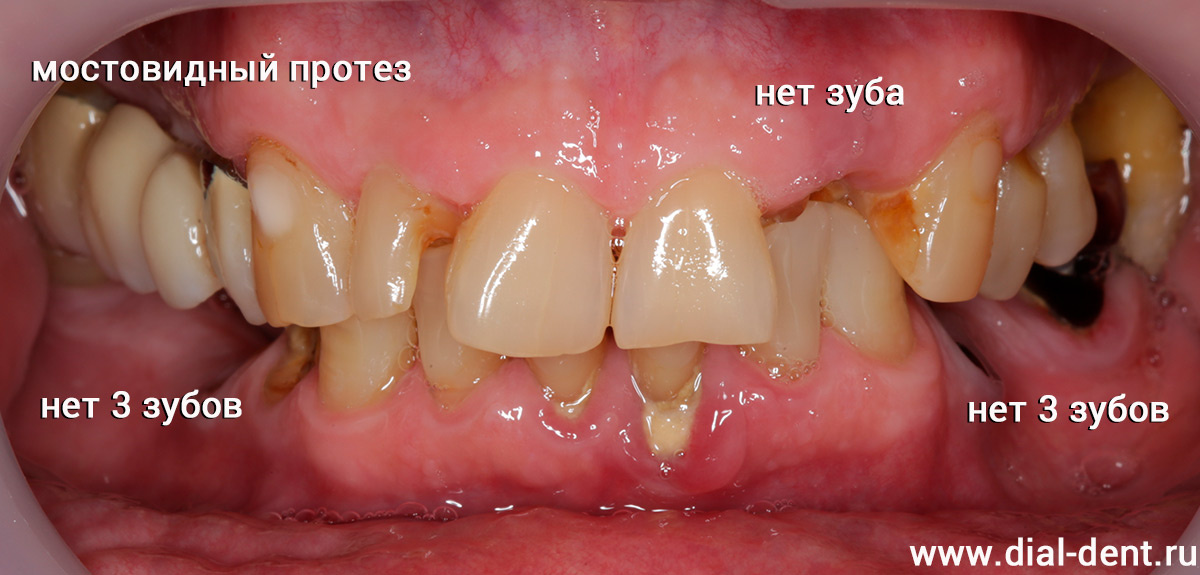 вид зубов при обращении