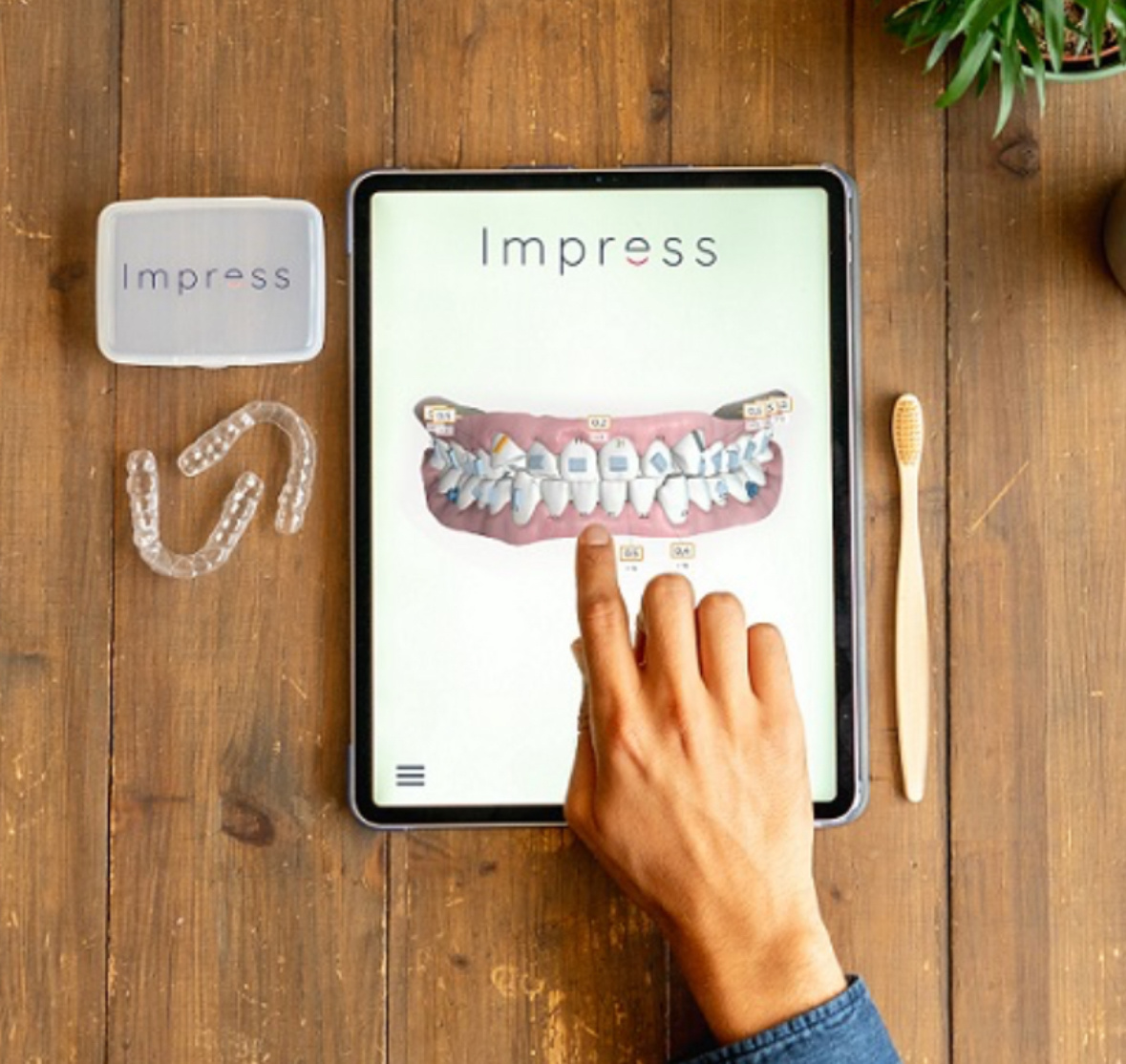 Impress - не советую. Лучше Invisalign и еще есть Star Smile, если не ошибаюсь, тоже хорошие то менее раскрученные чем Invisalign