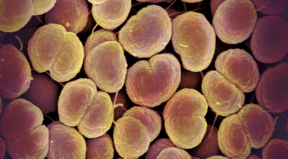   NIAID / Flickr / CC BY 2.0