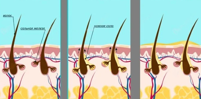 Работа сальных желез наглядно