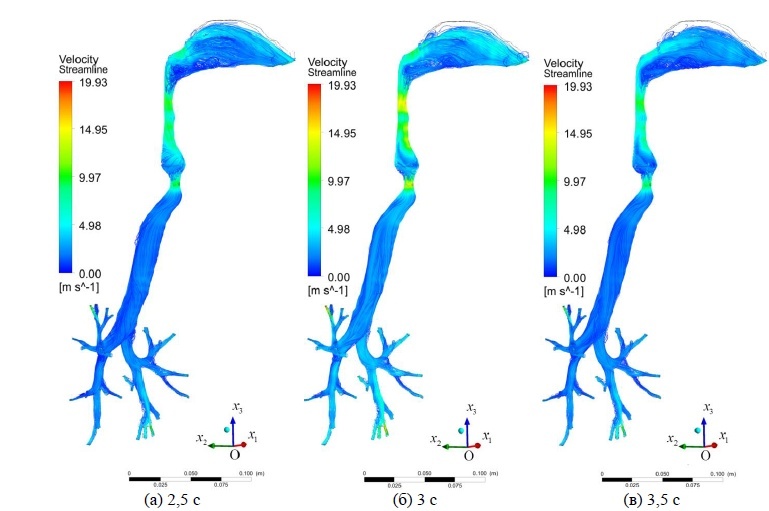 Фото: Михаил Цинкер. Линии тока скорости воздуха в воздухоносных путях во время выдоха