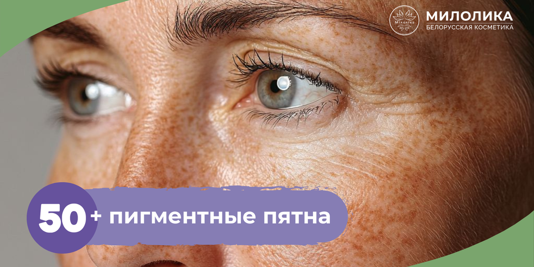 Как избавиться от пигментных пятен после 50