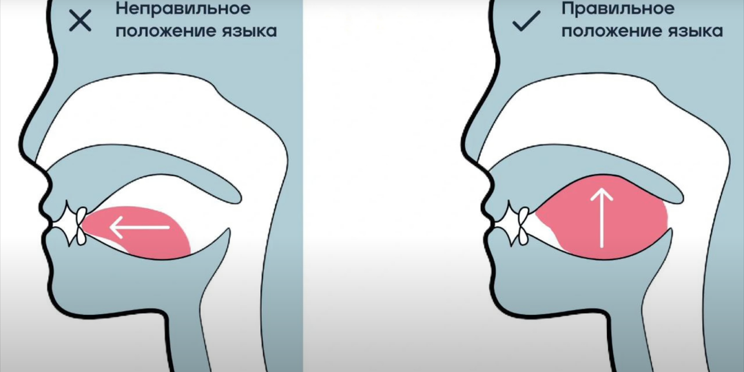Почему у современных детей кривые зубы?