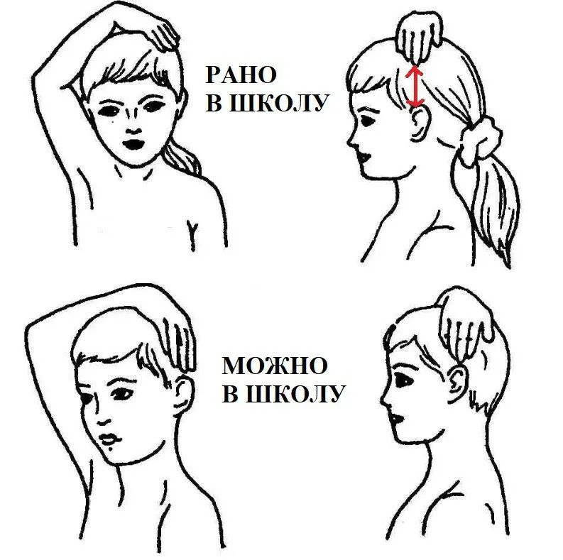 Филиппинский тест. 