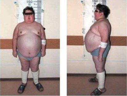 Иллюстративное фото из открытых источников