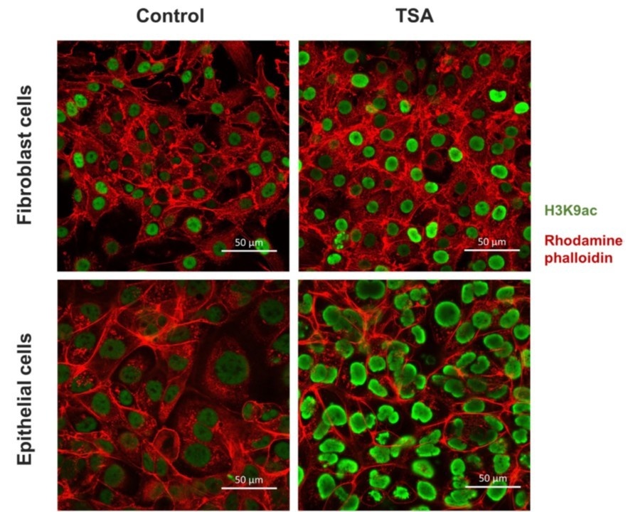 Статус ацетилирования клеток эпителиоцитов и фибробластов почки после обработки трихостатином А. Источник: Buyan et al. / IUBMB Life, 2025
