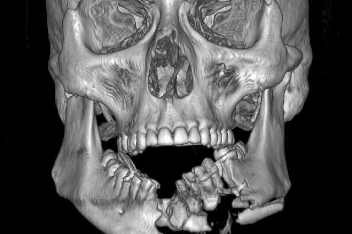    Травмы были ужасными.