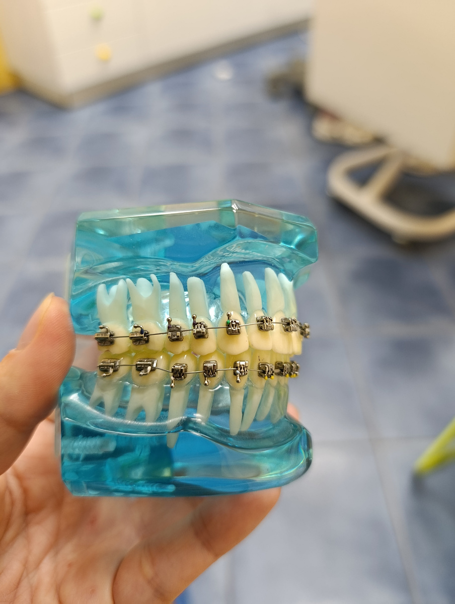 Макет челюсти с брекетами. На маркетплейсах ещё и брекеты фальшивые продаются, и люди зачем-то клеят их себе на зубы. Только не говорите, что это потому, что на настоящие денег нет. Не верю.