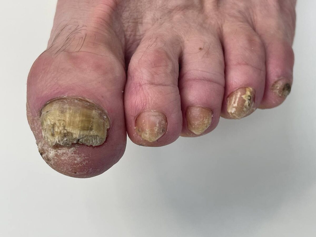 ДО обработки. Листайте галерию, чтобы увидеть ПОСЛЕ обработки