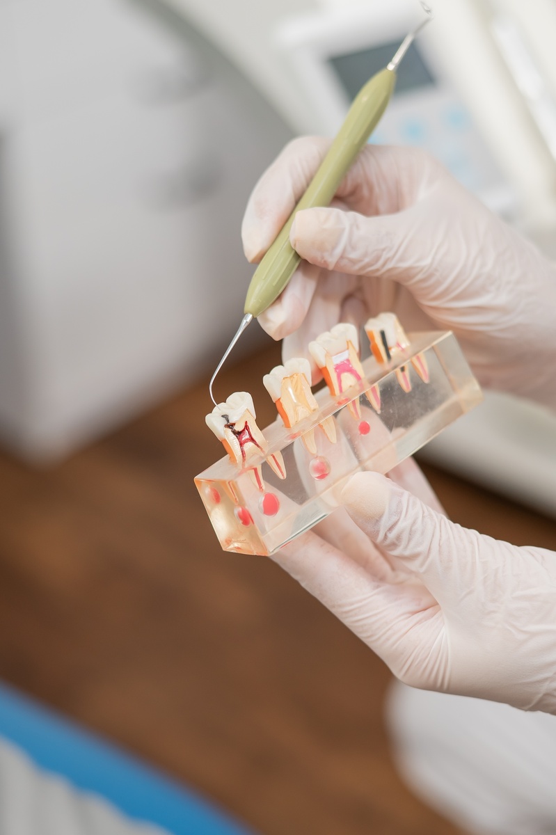 фотосессия стоматологических макетов