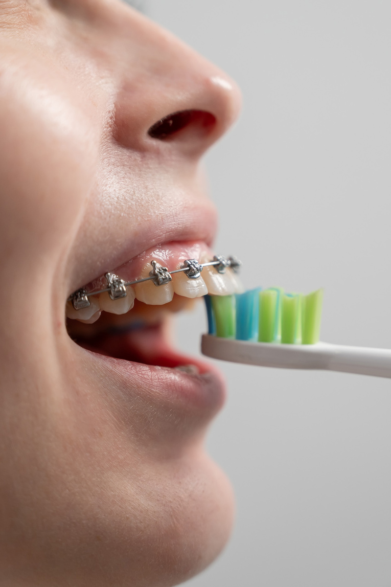 фотосессия для Белой стоматологии Новосибирск