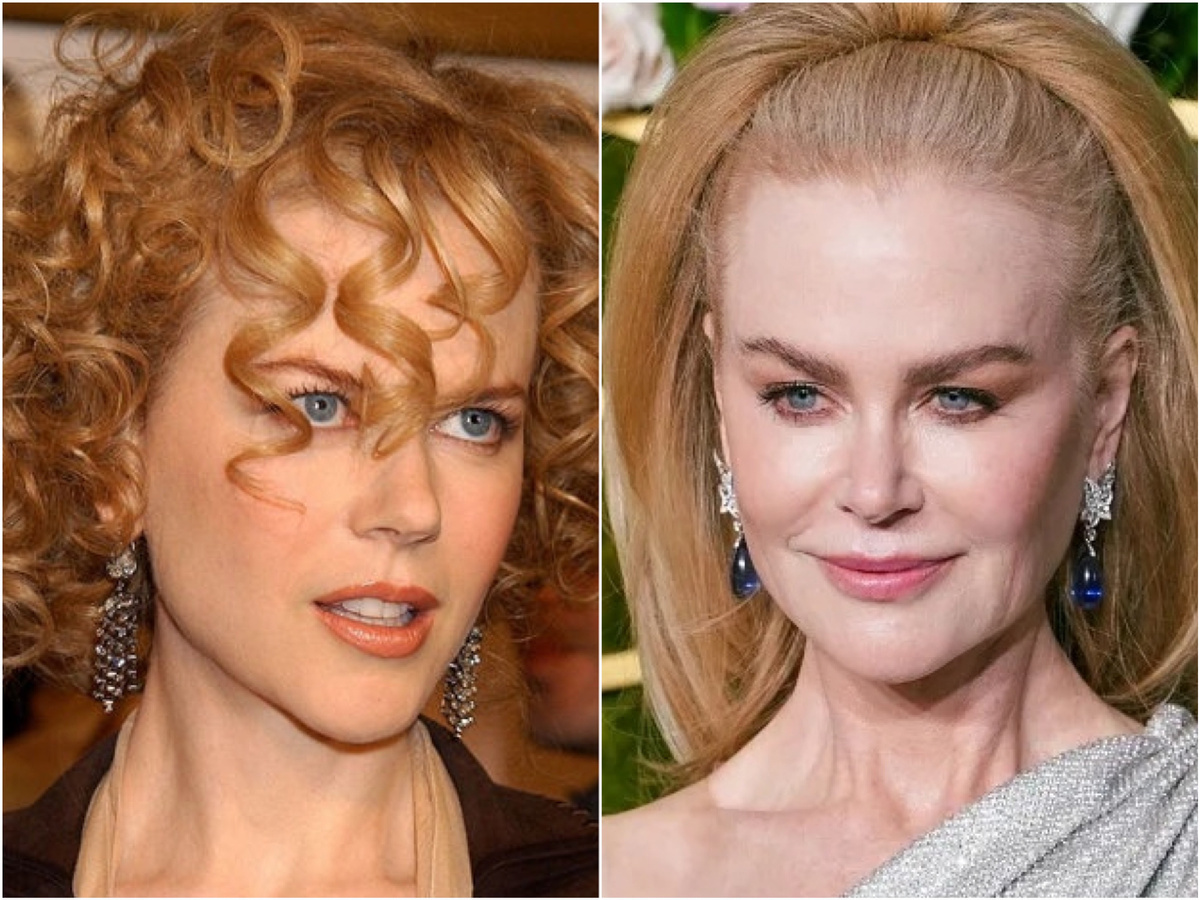 Николь Кидман