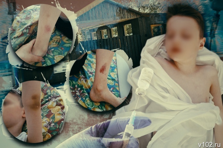 «Он был весь в синяках»: 8-летний волгоградец на второй день в детском лагере...