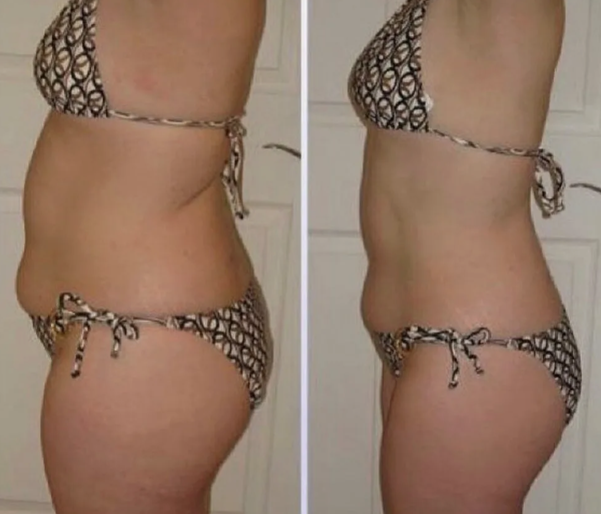 Фотка коллег. В моей программе фотоэксгибиционизм не приветсвуется. Я не унижаю так женщин