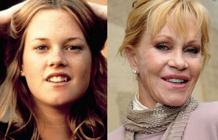 Зачем они это сделали: как неудачно выглядели 11 звёзд кино до и после пластики