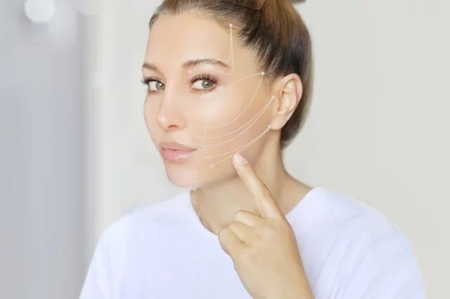    Как работают нитевые лифтинги?