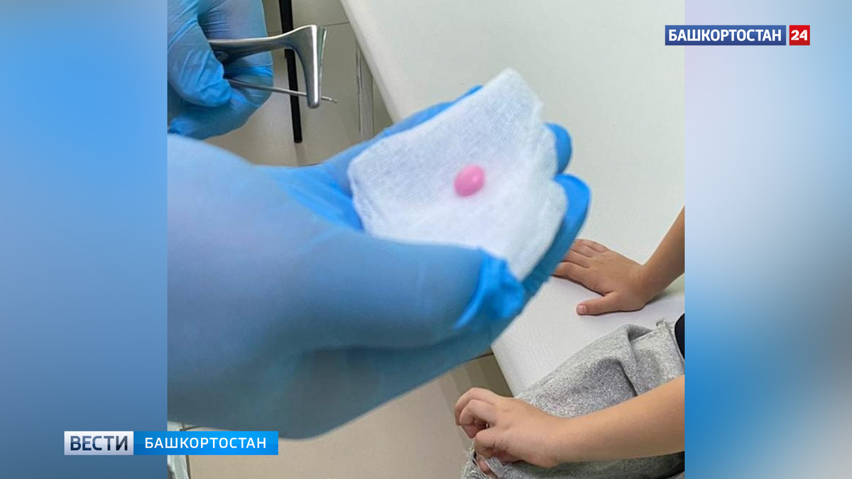    В Башкортостане врач извлек таблетку из носа девочки