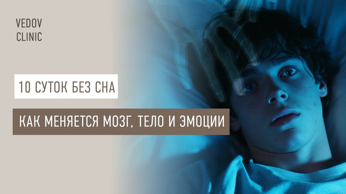 10 суток без сна