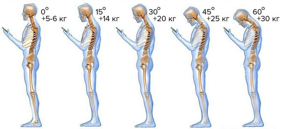 Рис: (text neck) Habr.com