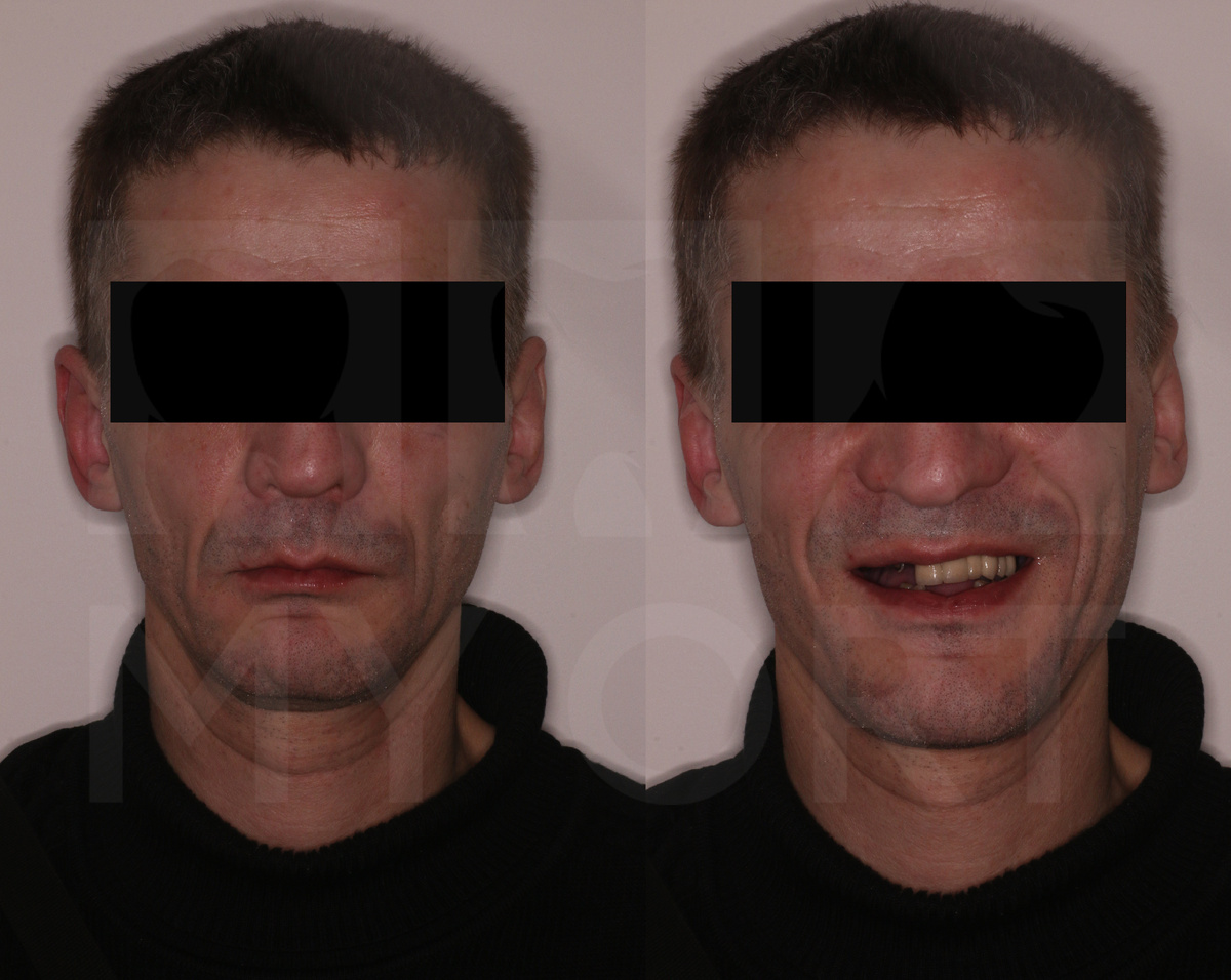 Ситуация лечения