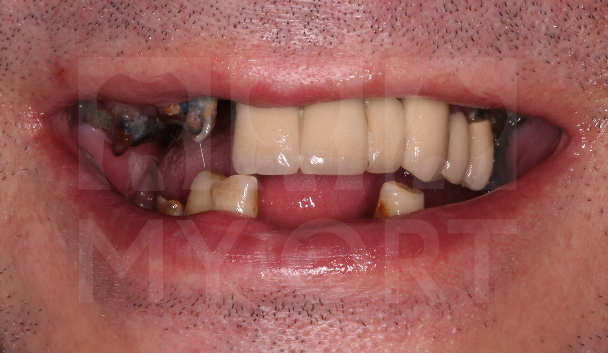 Листайте фотографиии ->