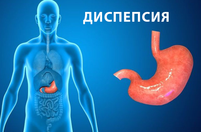 Что такое функциональная диспепсия (ФД)?