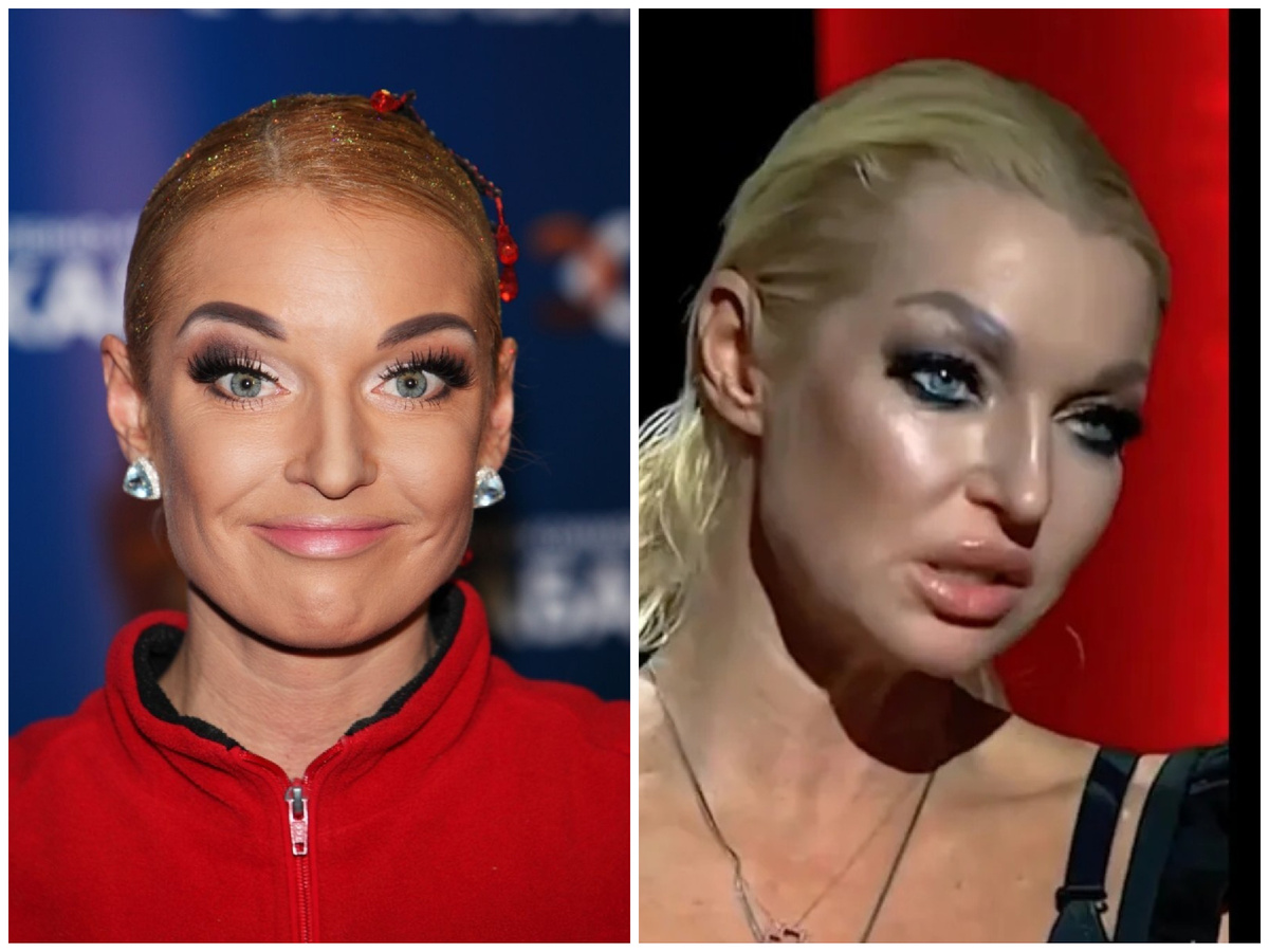 Анастасия Волочкова