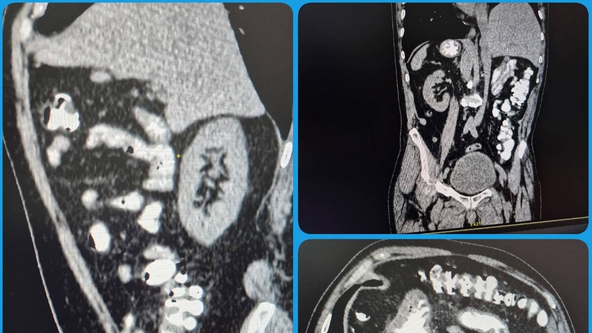    Фото: пресс-служба Балаковской городской клинической больницы