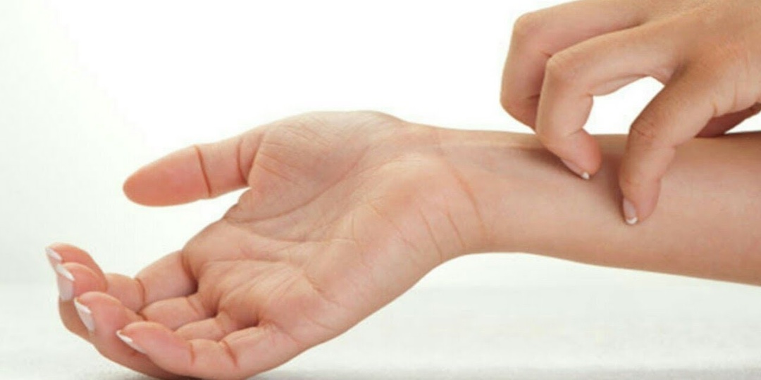 Что может значить зуд без сыпи: Сигнал от организма, который нельзя игнорировать