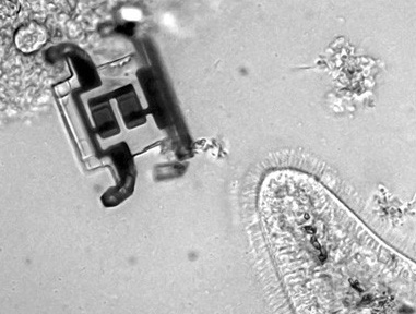 Пример наноробота в медицине. Фото: medichrome