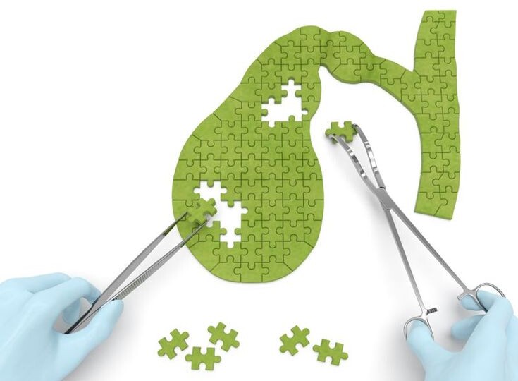 Оставьте в покое желчный пузырь!