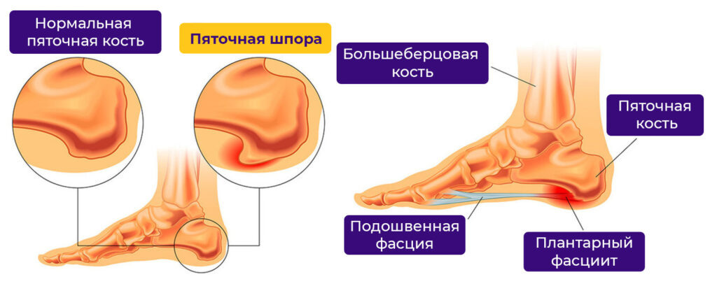 картинка из интернета