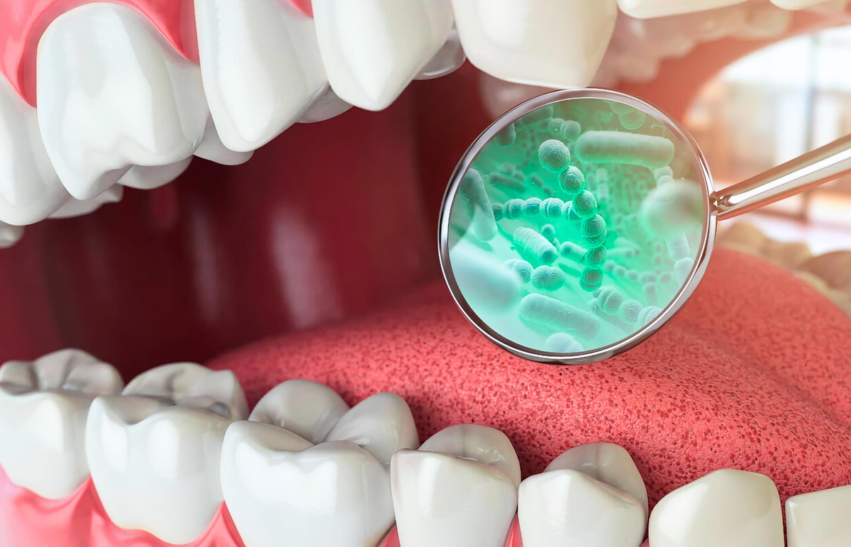 Рассказываем что такое микробиом полости рта и почему он важен