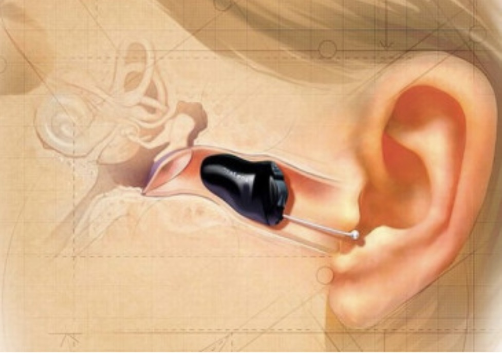 Сегодня, во время современных цифровых технологий, стали доступными слуховые аппараты, которых практически не видно.
Современный слуховой аппарат - это эстетично.