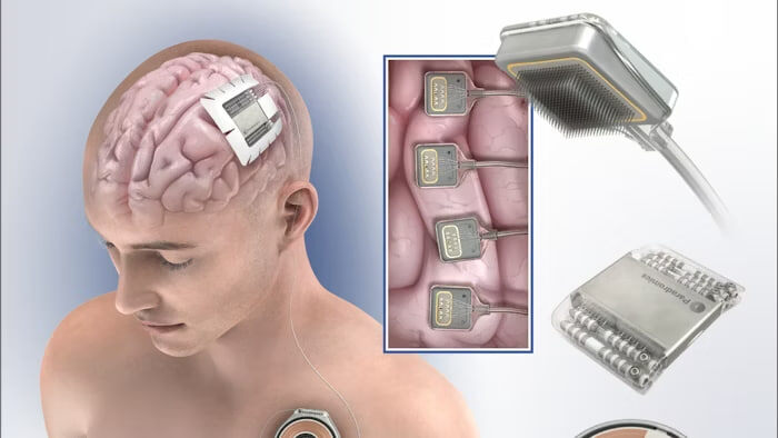 medicaldesigndevelopment.com