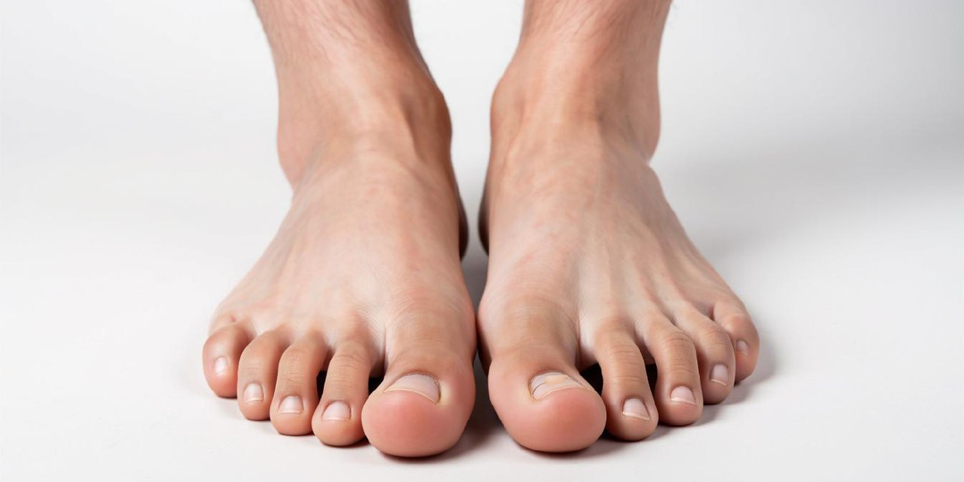 Что такое ортониксия и как она помогает при вросшем ногте?