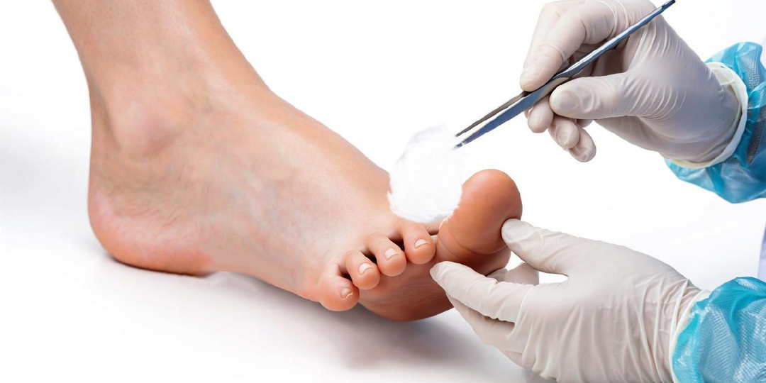 Как подолог решает проблемы повреждений околоногтевых валиков, кутикул и трещин