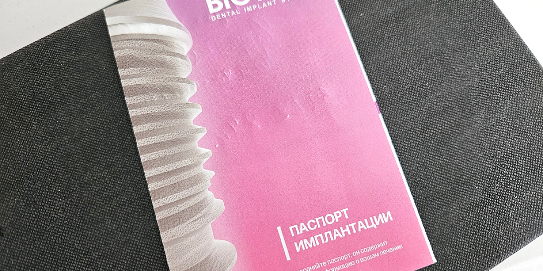 Имплантация зубов: мой опыт длиной больше года. Цены, сроки, боль и т.п.