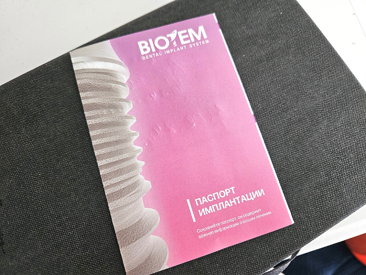 У меня импланты BioTem