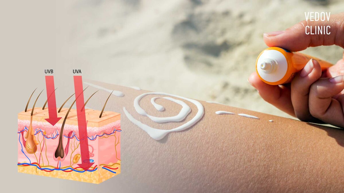 UVA‑излучение