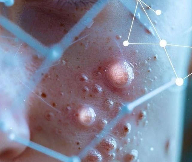 Ретинол: секрет сияющей кожи и мощный антиэйджинг агент в косметике