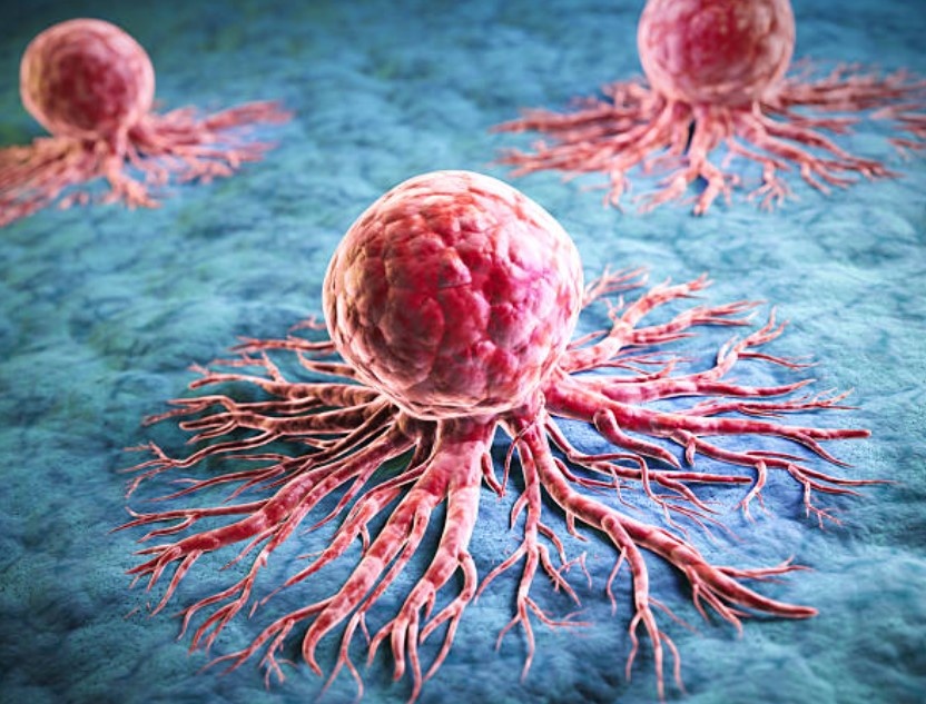 Аномальный рост раковых клеток. Источник: www.istockphoto.com