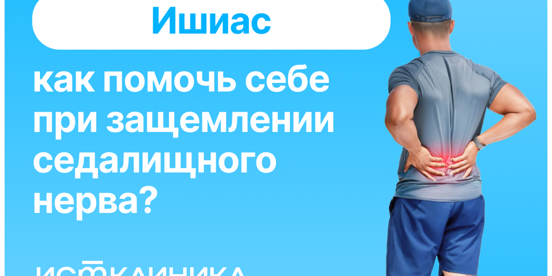 Ишиас: как помочь себе при защемлении седалищного нерва?