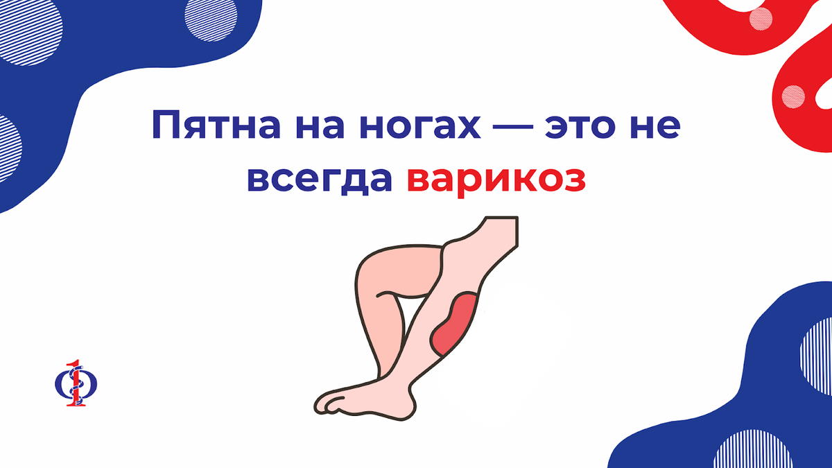 🔴 Пятна на ногах — это не всегда варикоз. Важно не перепутать диагноз