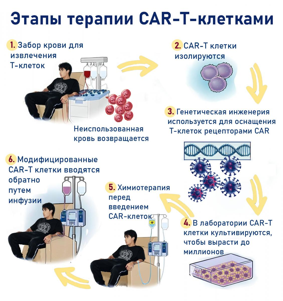 The six stages of CAR-T cell therapy illustrating the process from blood collection to modified CAR-T cell infusion 