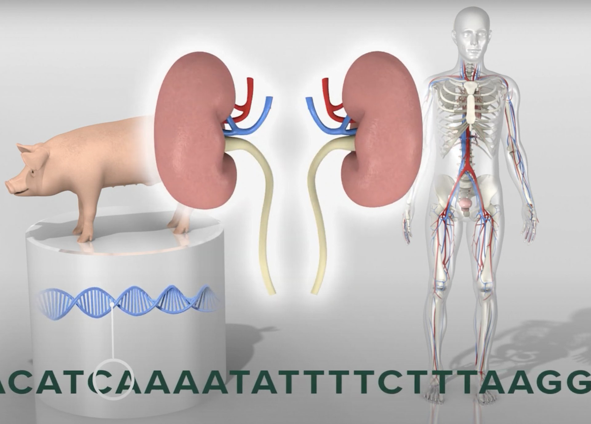 Conceptual illustration of genetically modified pig kidneys for xenotransplantation into humans showing the pig, kidneys, and a human anatomical figure 